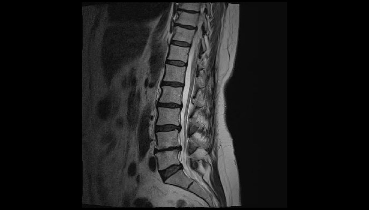 diagnosticul durerii de spate în regiunea lombară