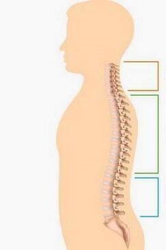 înfrângerea prin osteocondroză a diferitelor părți ale coloanei vertebrale